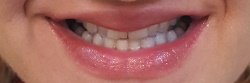 Natick Family Dental Natick Family Dental